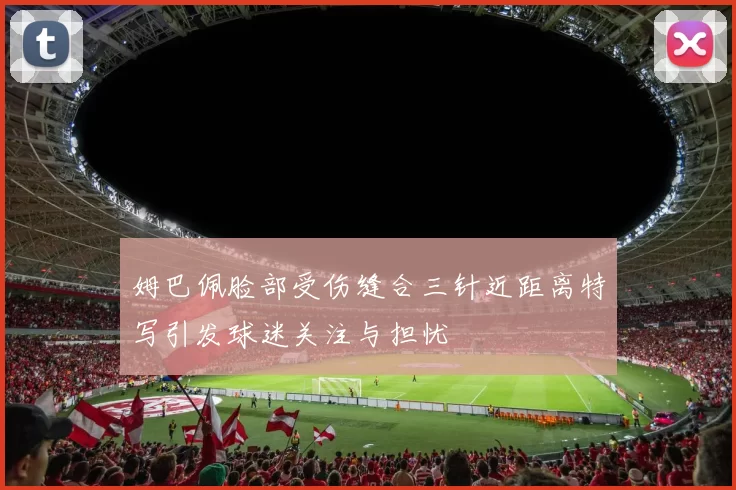 姆巴佩脸部受伤缝合三针近距离特写引发球迷关注与担忧
